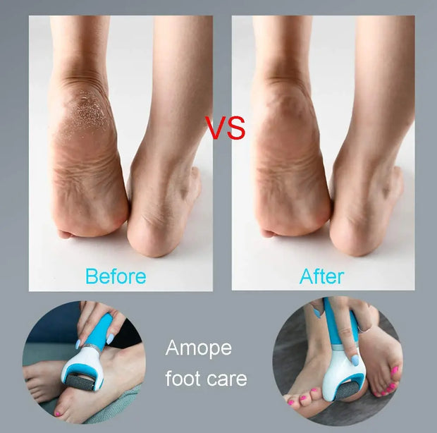 Electric Foot Care Tool